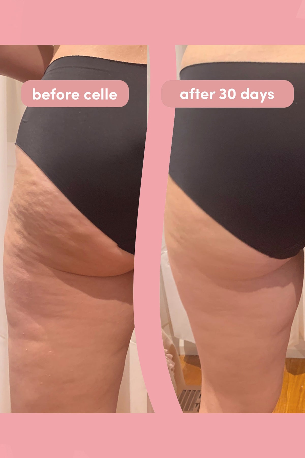 Before and after 30 day results